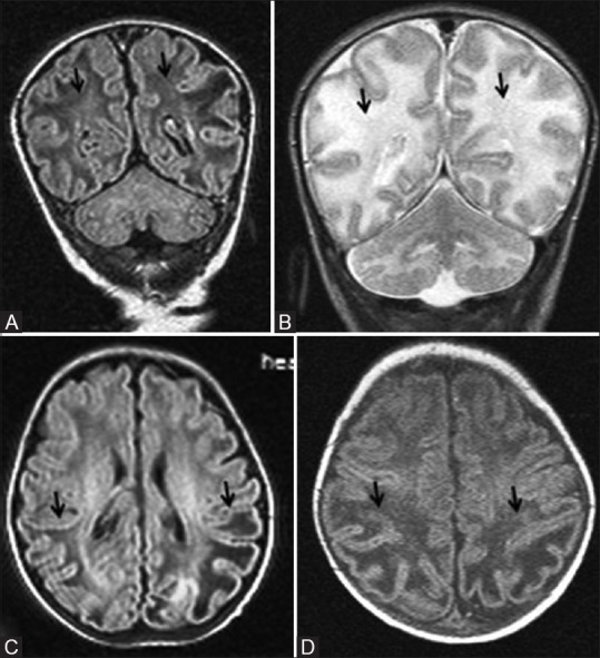 Figure 20 (A-D)