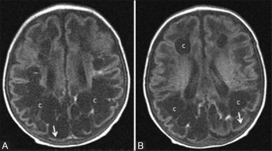 Figure 21 (A and B)