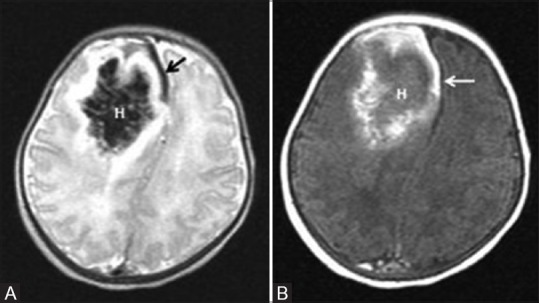 Figure 19 (A and B)