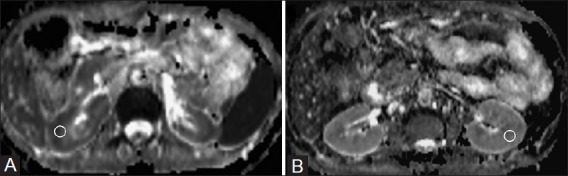 Figure 2 (A, B)