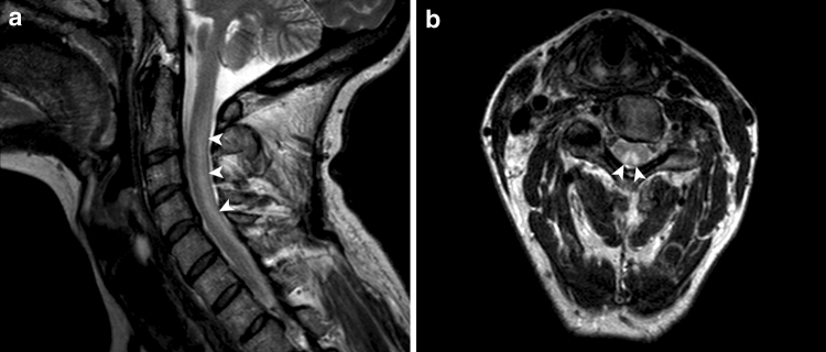 Fig. 4