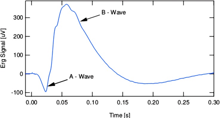 FIG. 14.