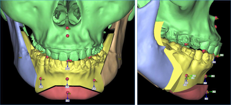 Figure 6.