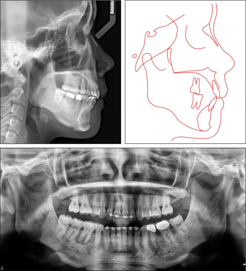 Figure 10.