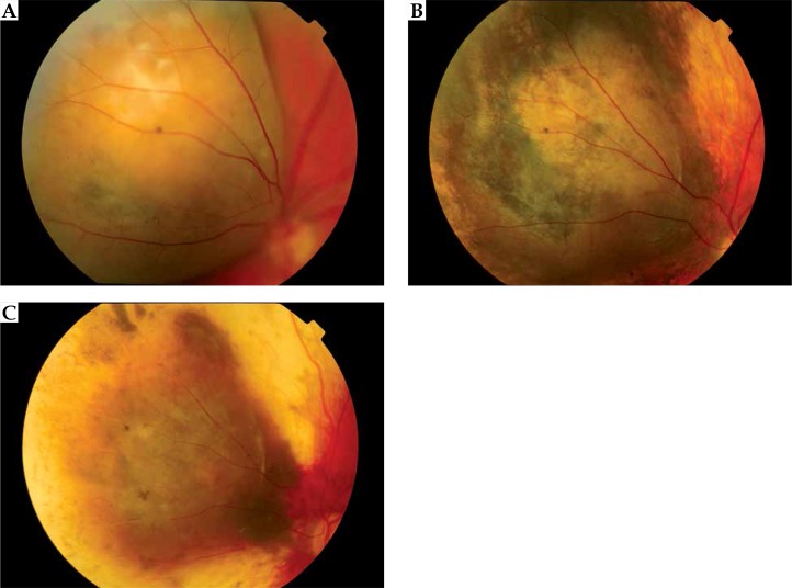 Fig. 3