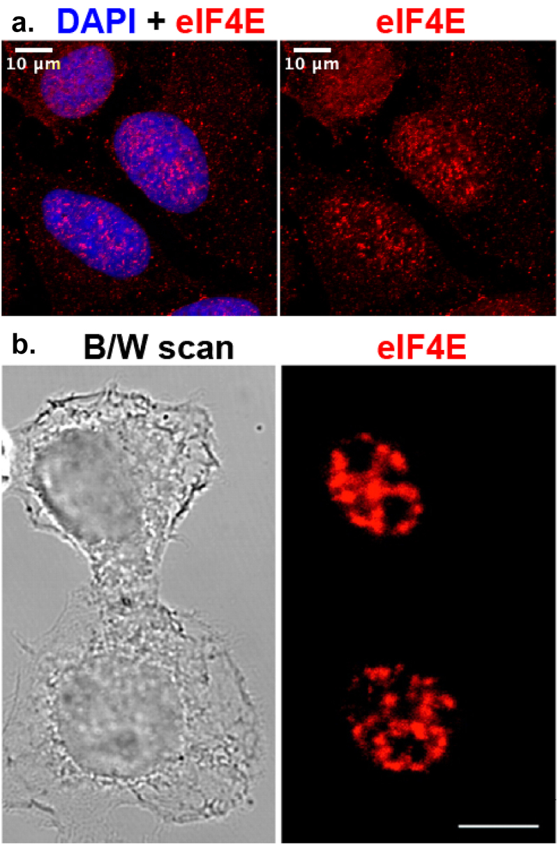 A. The top left panel shows DAPI staining of nuclei of three individual U2OS cells merged with the red signal of eIF4E staining, and on the right panel, the staining for eIF4E alone is seen in the same cells. Enrichment of eIF4E in the nuclei of cells is clear, cytoplasmic signal is also visible, showing a particulate and dispersed pattern through the nucleus and cytoplasm. B. The bottom left panel represents the phase contrast image of the two HeLa cells. The right panel represents eIF4E staining of the same cells showing predominantly nuclear localization.