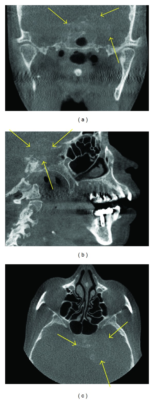 Figure 9