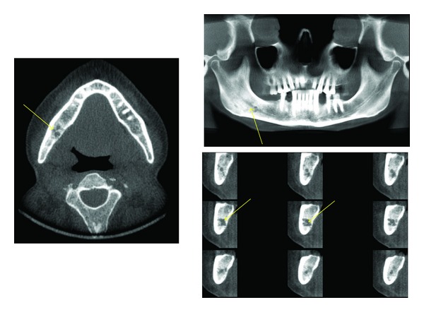 Figure 10