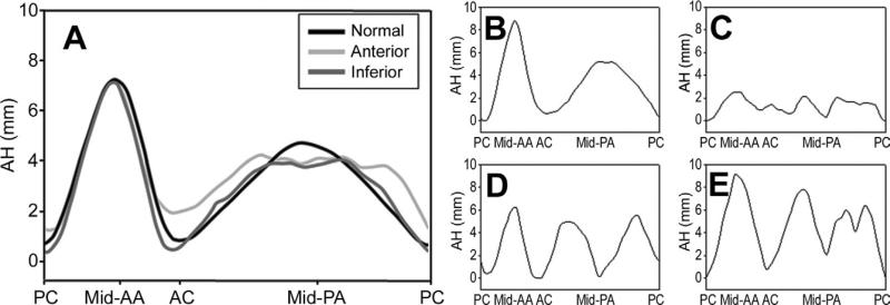 Fig 4