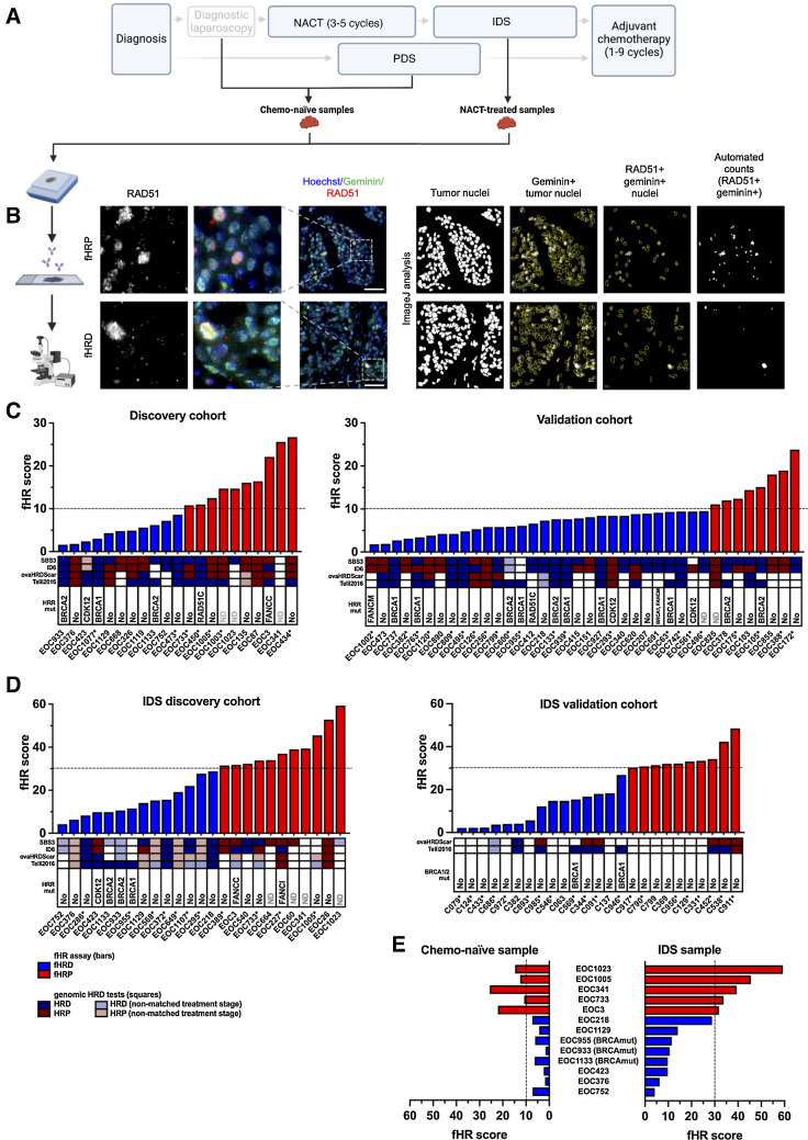 Figure 1. RAD51-based assay to determine fHR capacity from chemo-naïve and NACT-treated clinical HGSC specimens. A, Diagram showing the sample collection. Chemo-naïve samples were obtained from PDS or DL. NACT-treated specimens were obtained from IDS. B, Workflow of the fHR assay. Example images of geminin (green) and RAD51 (red) double stained fHRD and fHRP samples with ImageJ analysis illustration. Number of RAD51 and geminin double positive nuclei divided by the number of geminin-positive nuclei provides the fHR score. C and D, Distribution of fHR scores in chemo-naïve samples (C), as well as in the IDS (NACT-treated) samples (D), shown separately for discovery and validation cohorts. Dashed line indicates the proposed fHRD versus fHRP cutoffs. Colored squares depict HRD estimates from genomics-based assays, with blue shades corresponding to HRD and red shades to HRP. “Non-matched treatment stage” refers to cases where the genomics-based estimate of the patient was obtained from a different surgery sample (PDS/DL vs. IDS) than the fHR score. Deleterious mutations in HR genes identified from WGS/WES data are indicated for each patient. For the IDS validation cohort, only BRCA1/2 mutational testing results from the clinic were available. Asterisks indicate patients who received bevacizumab as part of their subsequent maintenance treatment. E, Comparison of fHR scores from chemo-naïve and IDS (NACT-treated) samples, obtained from the same patient (n = 13 patients). Abbreviations: ND, no data. (A, Created with BioRender.com.)