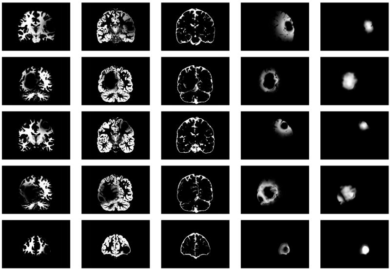 Fig. 13