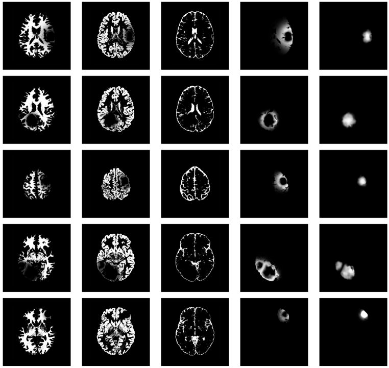 Fig. 12