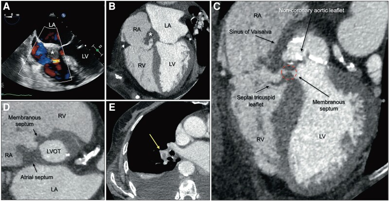 Figure 1