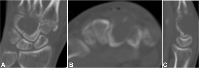 Figure 4