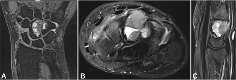 Figure 2