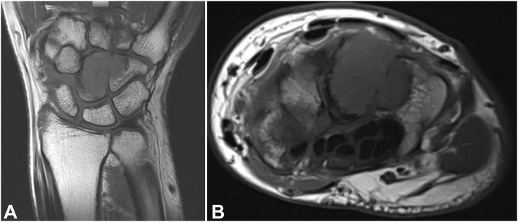 Figure 3