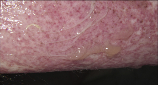 Fig 2
