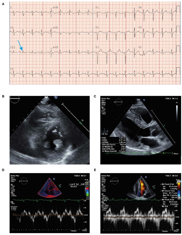 Figure 10