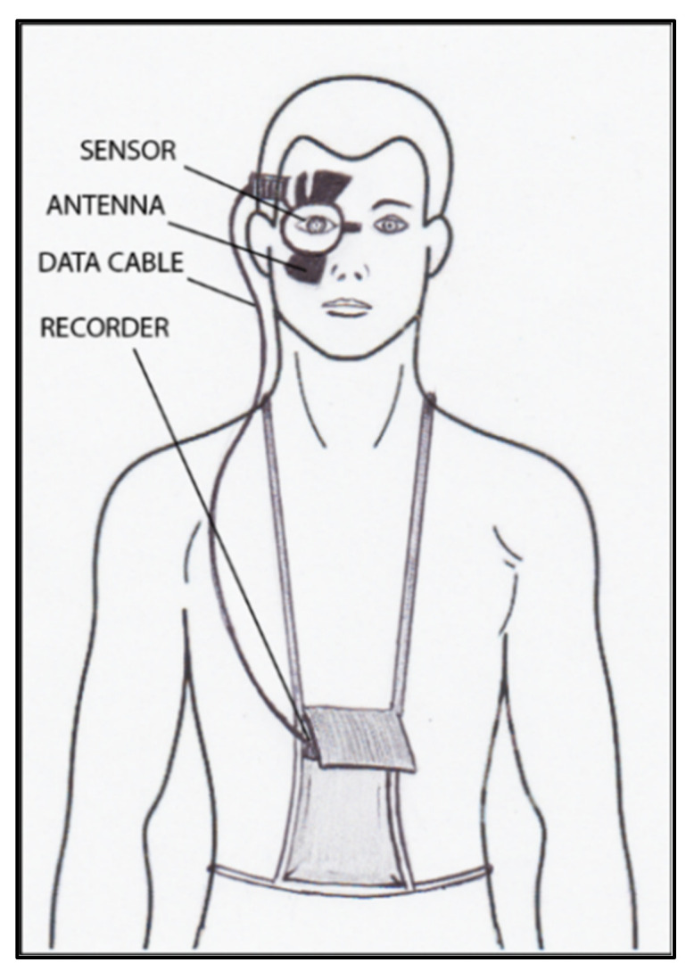 Figure 18