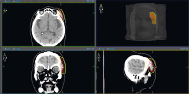Fig. 11
