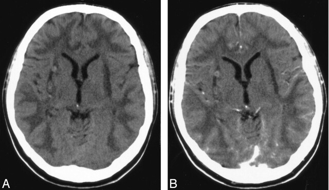 Fig 5.