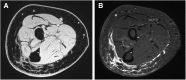 <b>FIG. 2.</b>