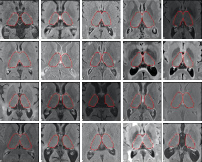 Fig. 3