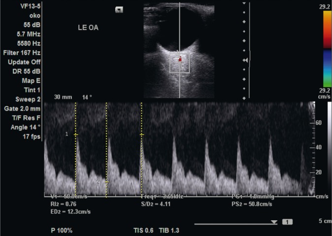 Fig. 2