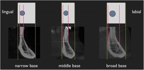 Fig. 11