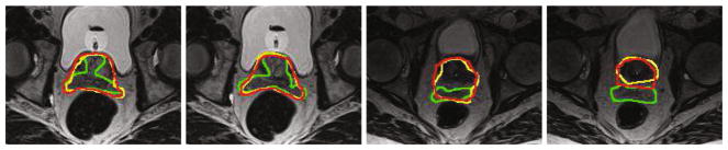 Fig. 5