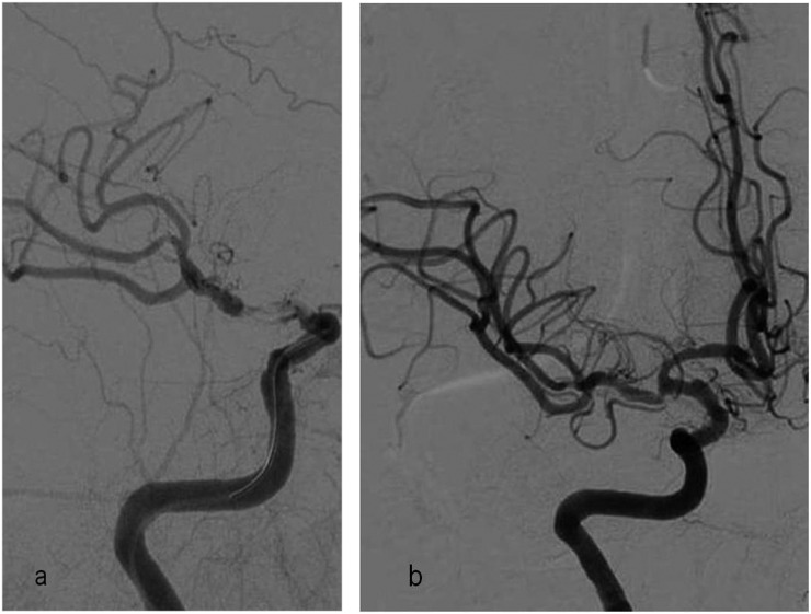 Figure 13.