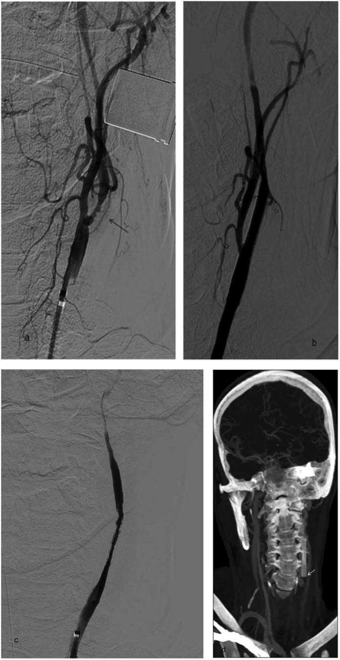 Figure 12.