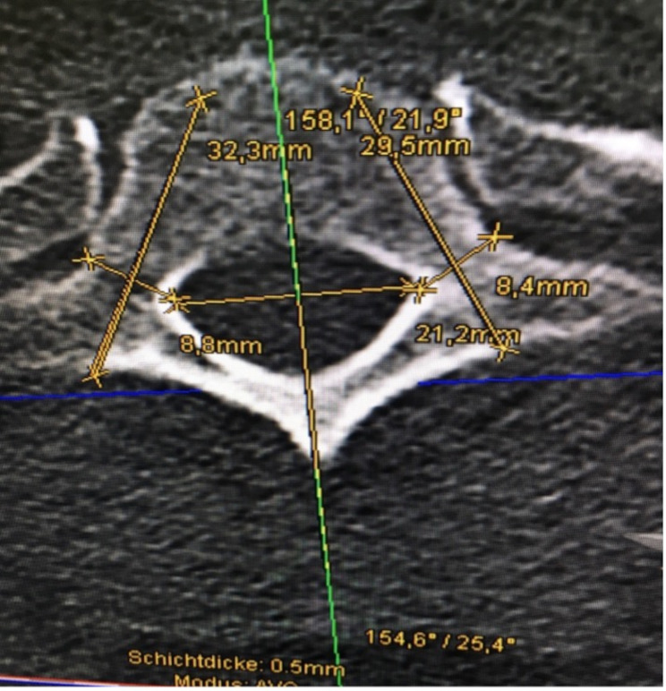 Fig. 2