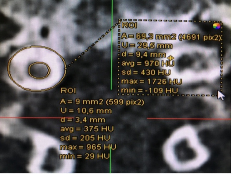 Fig. 3