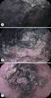 Fig. 2.