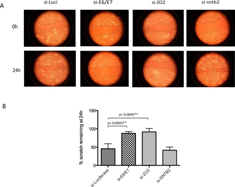 Fig 11