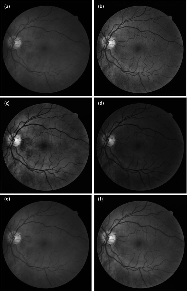 Fig. 6