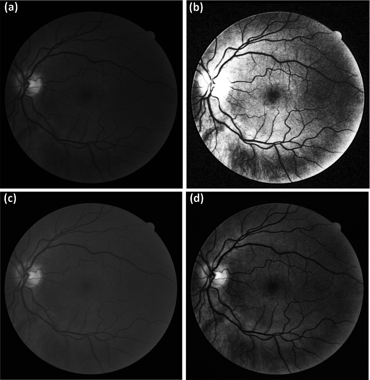 Fig. 1