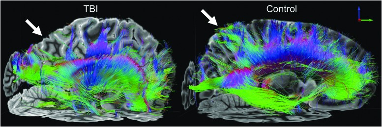 FIG. 6.