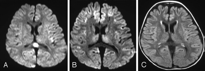 Fig 2.