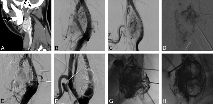 Fig 2.