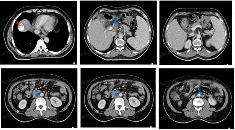 Figure 11