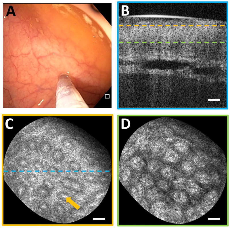 Fig. 3