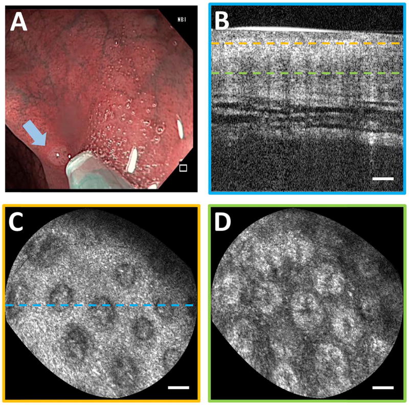 Fig. 4