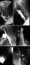 Fig. 3