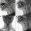 Fig. 1