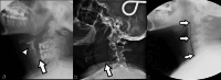 Fig. 4