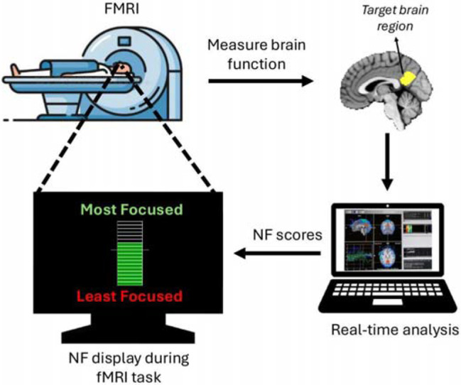 Figure 1: