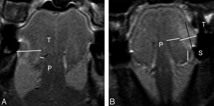 Fig 3.