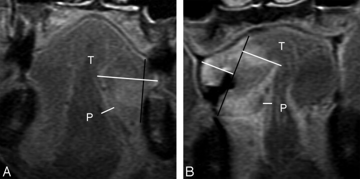 Fig 4.